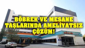 Böbrek ve Mesane Taşlarında Ameliyatsız çözüm Can Hastanesi'nde